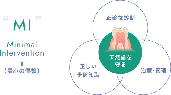 最小の侵襲 正確な診断 正しい予防知識 治療・管理 天然歯を守る