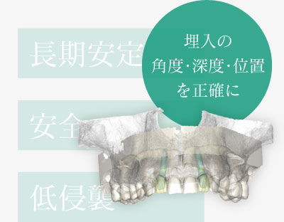 埋入の角度・深度・位置を正確に 長期安定 安全 低侵襲