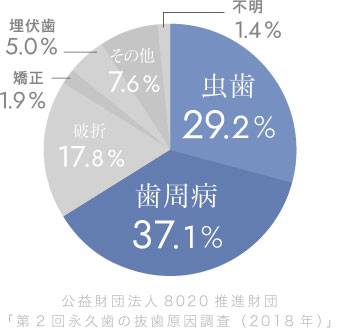 公益財団法人8020推進財団「第2回永久歯の抜歯原因調査（2018年）」 虫歯29% 歯周病37.1%