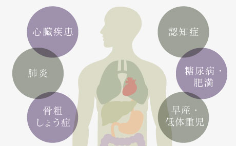 認知症 糖尿病・肥満 早産・低体重児 骨粗しょう症 肺炎 心臓疾患